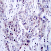 NF-kappaB p100 (Phospho-S869) Rabbit Polyclonal Antibody