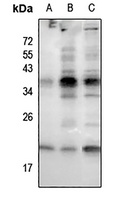 RAC1/2/3 (Phospho-S71) Rabbit Polyclonal Antibody