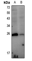 HSP27 (Phospho-S78) Antibody