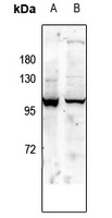 GLUR1 (Phospho-S863) Rabbit Polyclonal Antibody