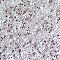 GLUR1 (Phospho-S863) Rabbit Polyclonal Antibody