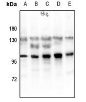 Glucocorticoid Receptor (Phospho-S203) Rabbit Polyclonal Antibody