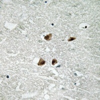 HSF1 (Phospho-S121) Rabbit Polyclonal Antibody