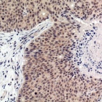 p53 (Phospho-T387) Rabbit Polyclonal Antibody