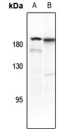 PDGFR beta (Phospho-Y771) Rabbit Polyclonal Antibody