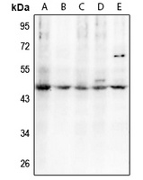 C/EBP alpha (Phospho-T230) Rabbit Polyclonal Antibody