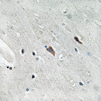 GAB2 (Phospho-Y643) Rabbit Polyclonal Antibody