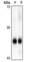 MK2 (Phospho-S272) Rabbit Polyclonal Antibody
