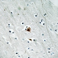 MK2 (Phospho-S272) Rabbit Polyclonal Antibody