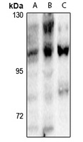 NFAT3 (Phospho-S168/S170) Rabbit Polyclonal Antibody