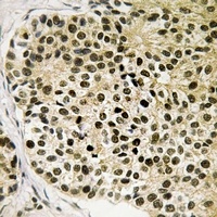 NFAT3 (Phospho-S168/S170) Rabbit Polyclonal Antibody