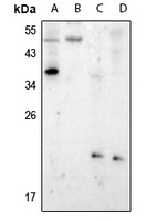 Presenilin 1 (Phospho-S357) Rabbit Polyclonal Antibody