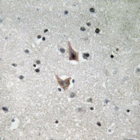 Presenilin 1 (Phospho-S357) Rabbit Polyclonal Antibody