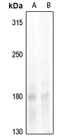 NCOA1 (Phospho-T1179) Rabbit Polyclonal Antibody