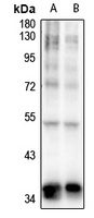 TOB (Phospho-S164) Rabbit Polyclonal Antibody