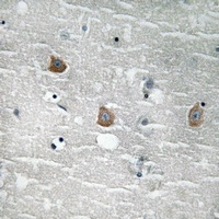 TOB (Phospho-S164) Rabbit Polyclonal Antibody