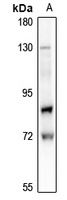 Lamin A/C (Phospho-S22) Rabbit Polyclonal Antibody