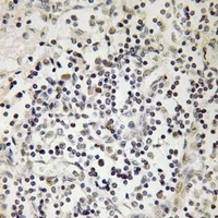 Lamin A/C (Phospho-S22) Rabbit Polyclonal Antibody