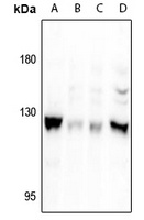 Focal Adhesion Kinase (Phospho-S722) Rabbit Polyclonal Antibody