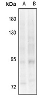 TRK B (Phospho-Y817) Rabbit Polyclonal Antibody