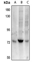 ZAP70 Rabbit Polyclonal Antibody