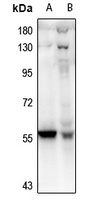 PFKFB2 Rabbit Polyclonal Antibody