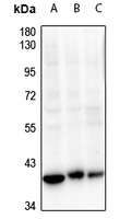 CDK7 Rabbit Polyclonal Antibody