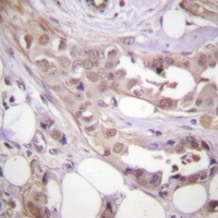 CDK7 Rabbit Polyclonal Antibody