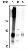 RB1 Rabbit Polyclonal Antibody