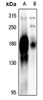 EGFR Antibody [KO/KD Validated]