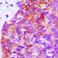 EGFR Antibody [KO/KD Validated]