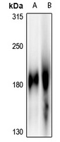 EGFR Antibody [KO/KD Validated]