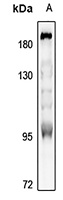 MUSK Rabbit Polyclonal Antibody