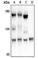 FARP2 Rabbit Polyclonal Antibody