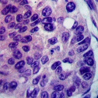 FARP2 Rabbit Polyclonal Antibody