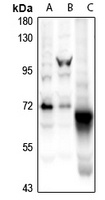 CaMK2 beta Rabbit Polyclonal Antibody
