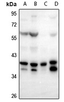 FOXB1/2 Rabbit Polyclonal Antibody
