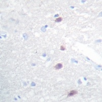 FOXB1/2 Rabbit Polyclonal Antibody
