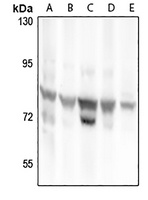 RhoBTB1 Rabbit Polyclonal Antibody