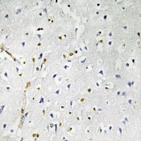 RhoBTB1 Rabbit Polyclonal Antibody