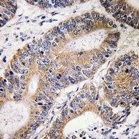 CDC16 Rabbit Polyclonal Antibody
