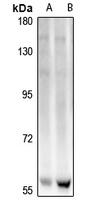 ELOA3 Rabbit Polyclonal Antibody