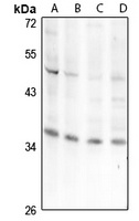 Aquaporin 5 Rabbit Polyclonal Antibody