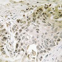 RFX2 Rabbit Polyclonal Antibody