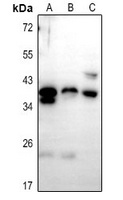 PTGR1 Rabbit Polyclonal Antibody