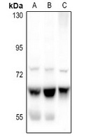 ME1 Rabbit Polyclonal Antibody