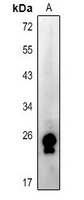 RAB15 Rabbit Polyclonal Antibody