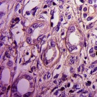 Septin 2 Rabbit Polyclonal Antibody