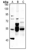 Alpha-internexin Rabbit Polyclonal Antibody