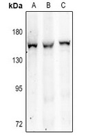 ITIH4 Rabbit Polyclonal Antibody